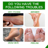 Herbal Anti Crack Foot Cream Heel Cracking Repair Products Exfoliation Dead Skin Removal Softening Moisturize Smooth Skin Care
