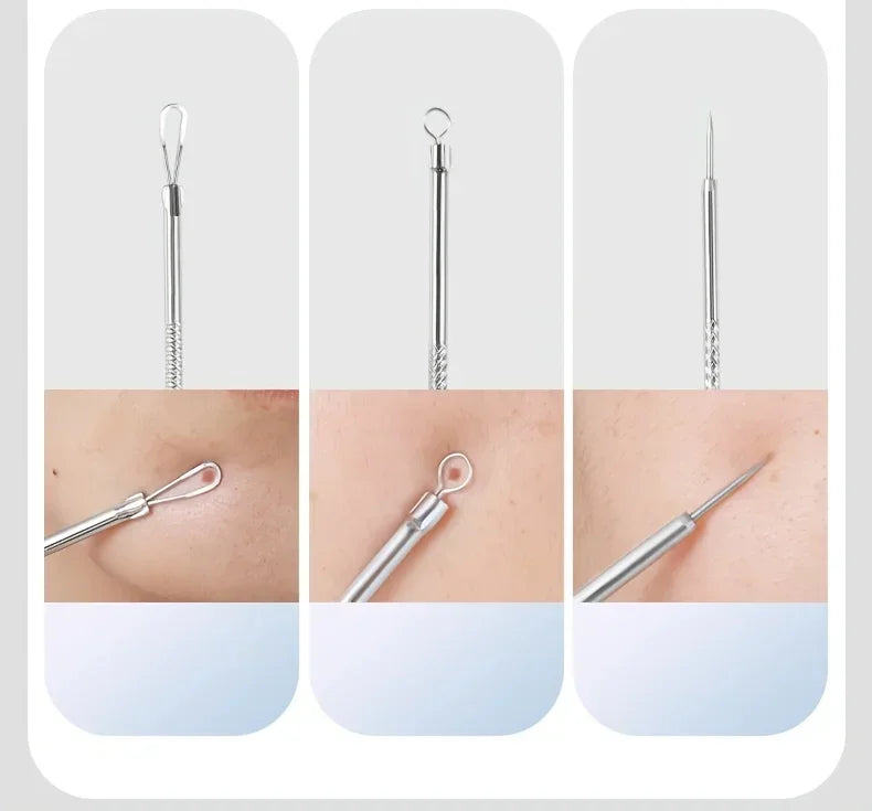 Optional 4Pcs 7Pcs 8Pcs Stainless Steel Skin Care Tool Set For Blackhead And Pimple Household Salon Grooming Accessory