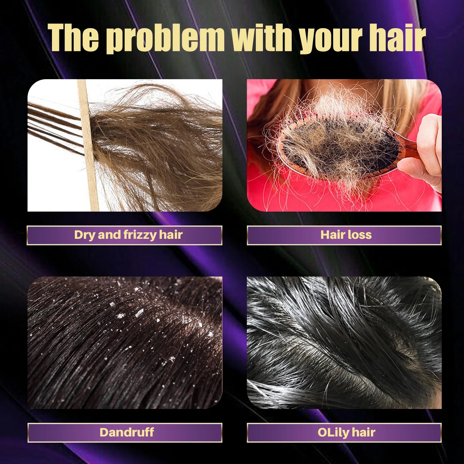 Hair Shampoo For Fast Hair Growth Rosemary Onion Hair Regrowth Shampoo Anti Hair Loss Effective Within 7 Day Hair Care Spray