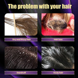Hair Shampoo For Fast Hair Growth Rosemary Onion Hair Regrowth Shampoo Anti Hair Loss Effective Within 7 Day Hair Care Spray