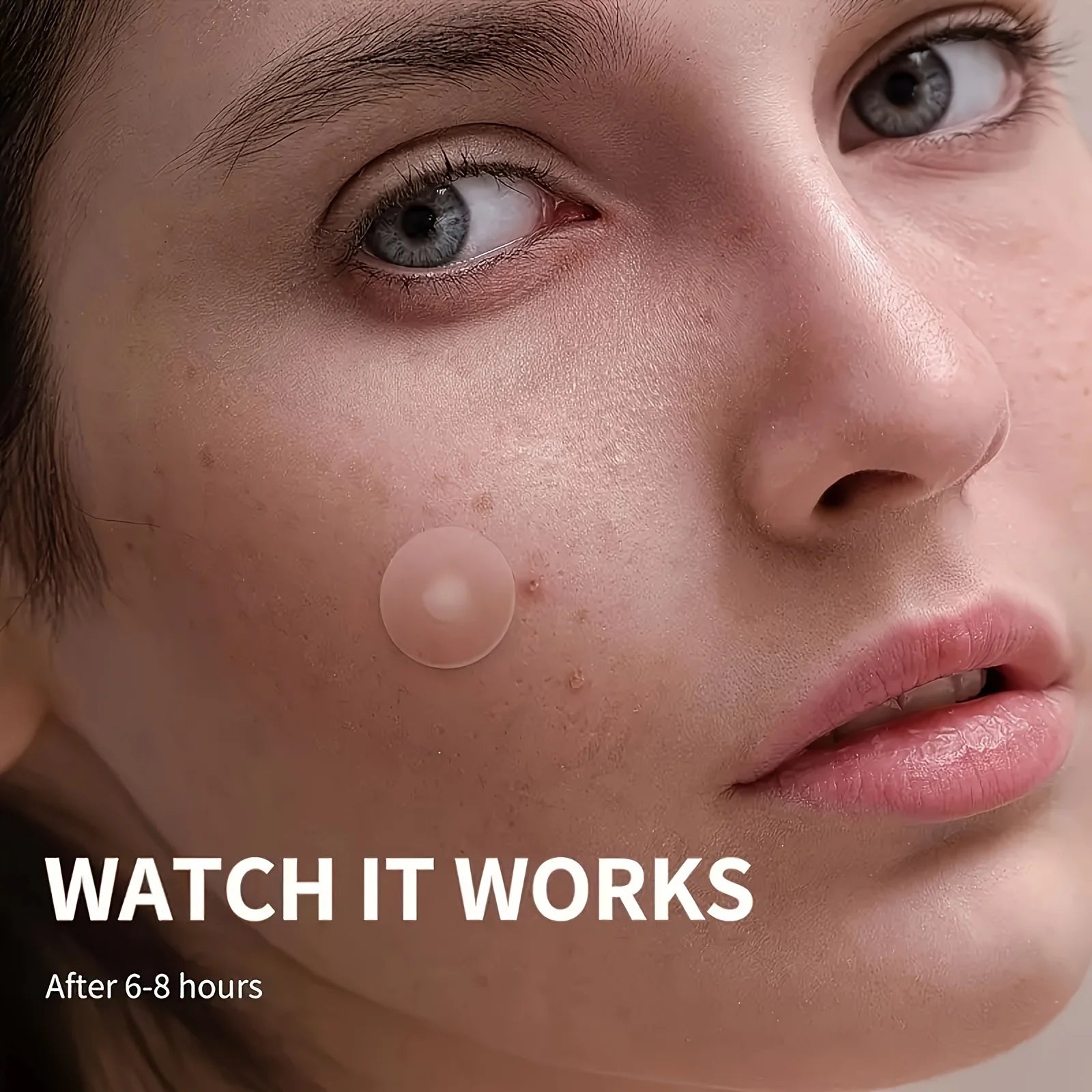 36pcs Skin-Calming Acne Patches - Hydrocolloid Technology Gently Heals Blemishes, invisibleProtection.