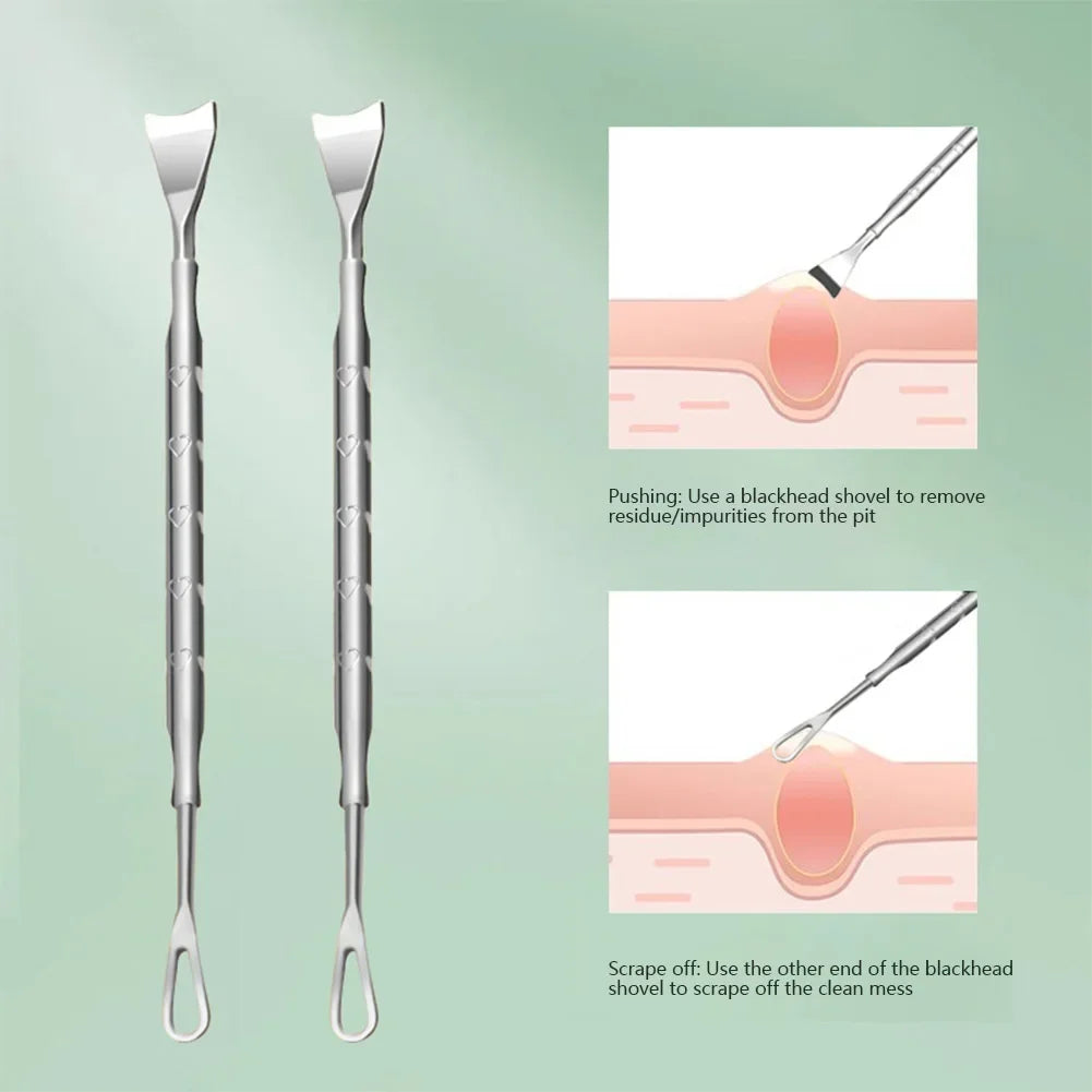 Blackhead Remover Pimple Popper Tool Acne Needle Removing Treatment Comedone Whitehead Popping Zit Nose Face Blemish Extractor