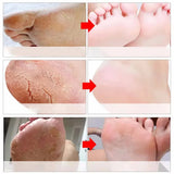 Herbal Anti Crack Foot Cream Heel Cracking Repair Products Exfoliation Dead Skin Removal Softening Moisturize Smooth Skin Care