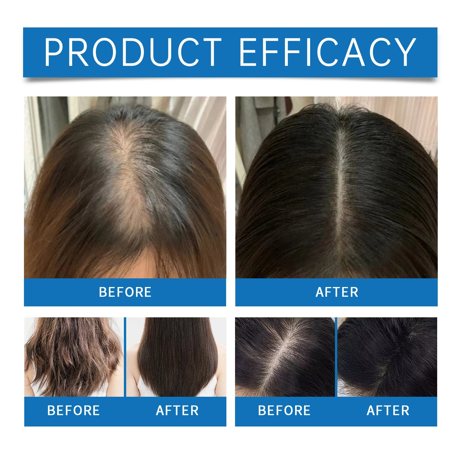Hair Nourishing Serum Roll-On Improves Scalp Health Strengthens Hair Roots Thicker and Healthier Looking Hair Scalp Treatment Essence for Thinning Hair