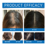 Hair Nourishing Serum Roll-On Improves Scalp Health Strengthens Hair Roots Thicker and Healthier Looking Hair Scalp Treatment Essence for Thinning Hair