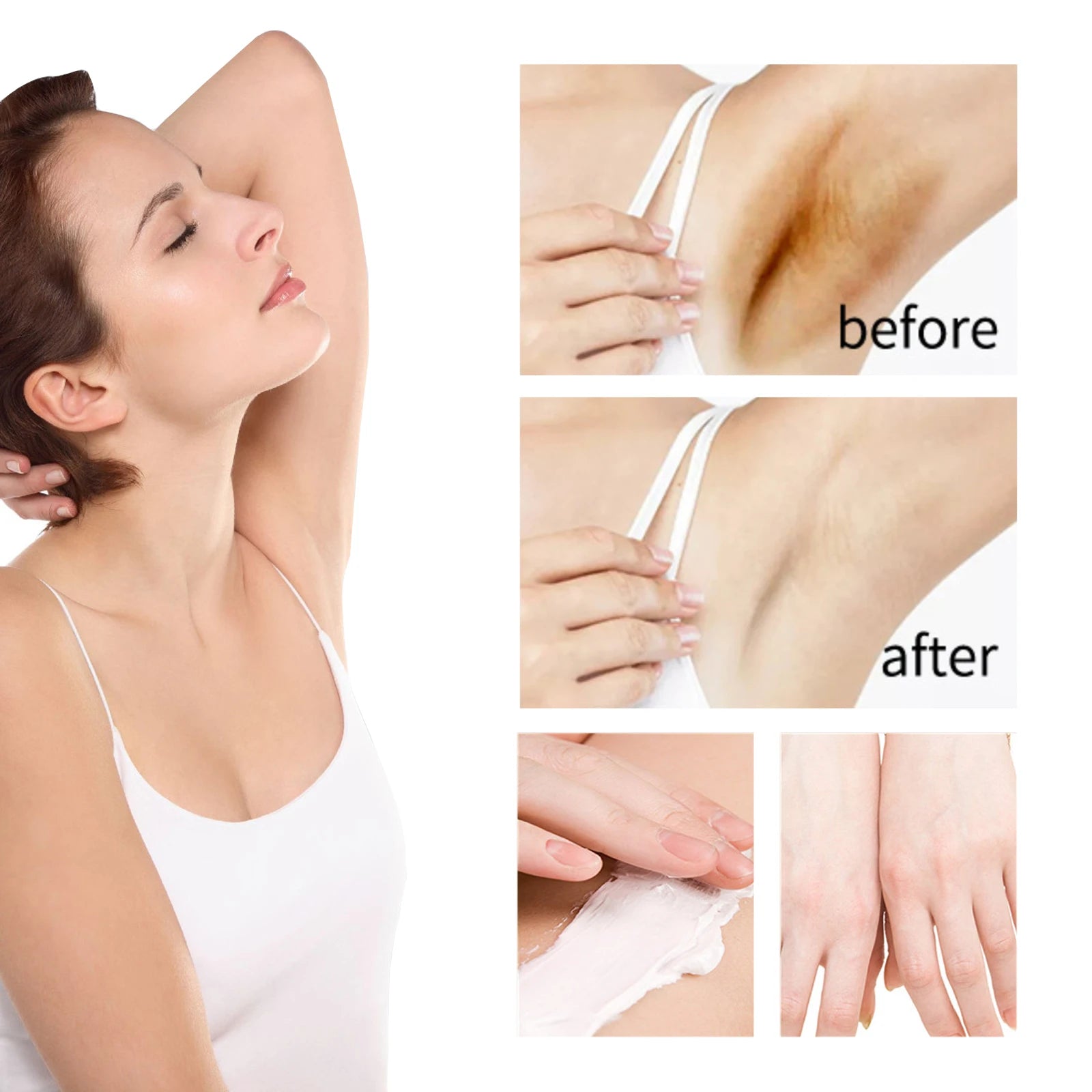 Whitening Cream For Dark Skin Underarm Armpit Thigh Inner Joint Lightening Sensitive Area Body Care Moisturizing Brighten Lotion