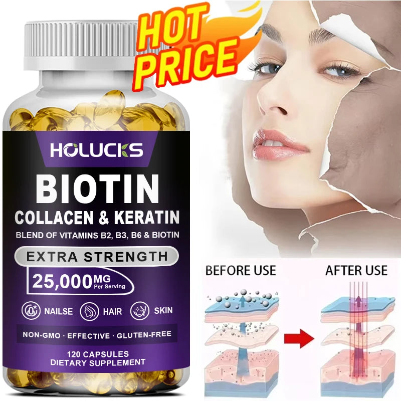 Biotin+Collagen+Keratin Capsules, Hydration, Promotes Hair Growth, Strengthens Weak Nails, Joints & Bones, Anti-Aging, Whitening