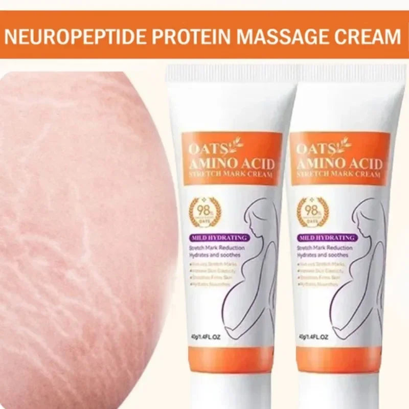 Stretch Marks Permanent Removal Cream Eliminate Body Belly Stretch Marks Swelling Marks Remove Skin Cracks Repair Firming Care