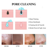 Blackhead Cleaning Mud Mask Stick Green Mask Stick Deep Pore Cleansing With Tea Tree Oil Gentle Formula For All Skin Types