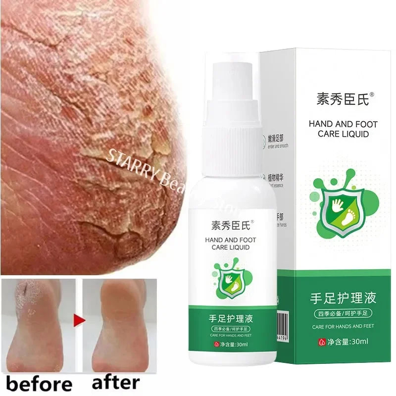 Herbal Anti Crack Foot Cream Spray Heel Cracking Repair Products Exfoliation Dead Skin Removal Softening Moisturize Smooth Care