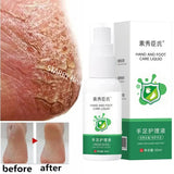 Herbal Anti Crack Foot Cream Spray Heel Cracking Repair Products Exfoliation Dead Skin Removal Softening Moisturize Smooth Care