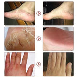 Herbal Anti Crack Foot Cream Heel Cracking Repair Products Exfoliation Dead Skin Removal Softening Moisturize Smooth Skin Care