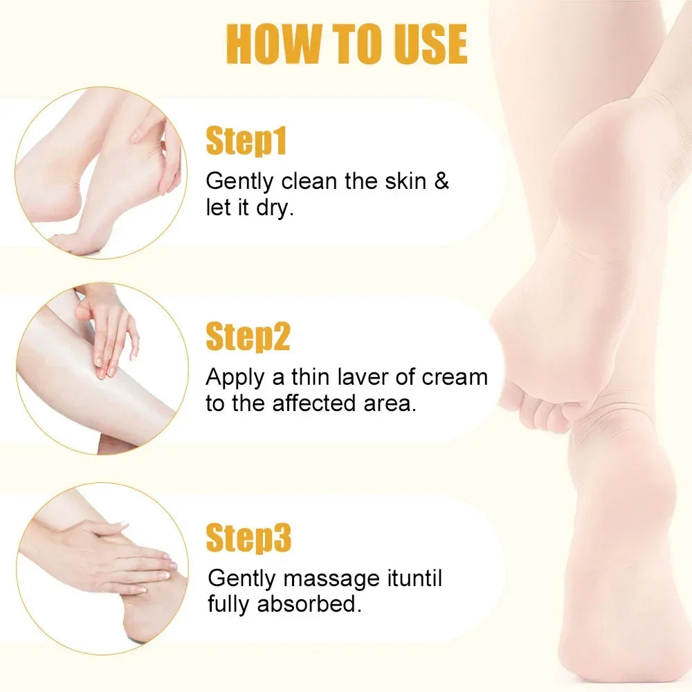 40g Ultra-Hydrating 60% Urea Foot Cream Aloe Vera for Softening Dry Cracked Feet - Gentle Exfoliation Daily Foot Care Solution