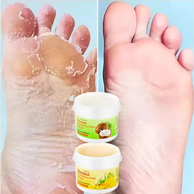 Herbal Anti Crack Foot Cream Heel Cracking Repair Products Exfoliation Dead Skin Removal Softening Moisturize Smooth Skin Care