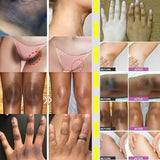 Niacinamide Whitening Cream Stick Remove Dark Spots Bleaching Private Parts Underarm  Brighten Butt Knee Inner Thigh Body Care