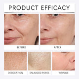 0.2MM Microneedle 2 Tools + 6 Bottles Korean Moisturizing Renewal Set, Firming & Anti-Fine Lines Daily Skin Care Essence