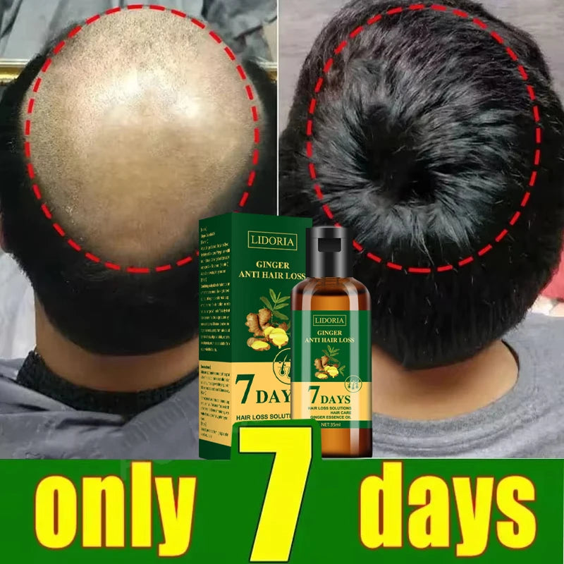 Hair Growth Serum 7 Days Fast Regrowth Essential Capsule Anti Hair Loss Baldness Repair Damaged Scalp Treatment For Women Men