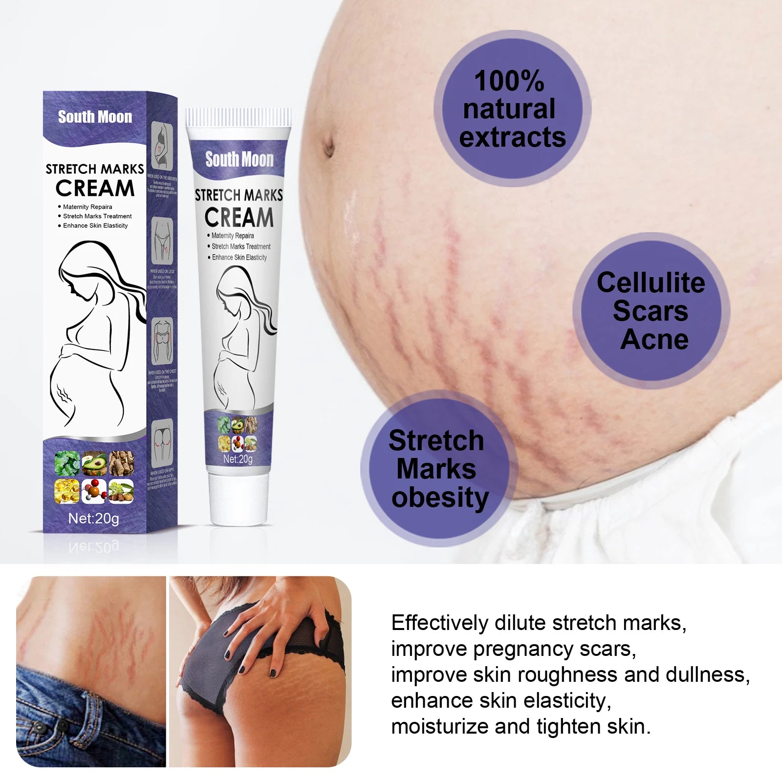 Remove Pregnancy Stretch Marks Cream Improves Elasticity Fade Growth Lines Smoothing Nourishing Moisturizing Firming Skin Care