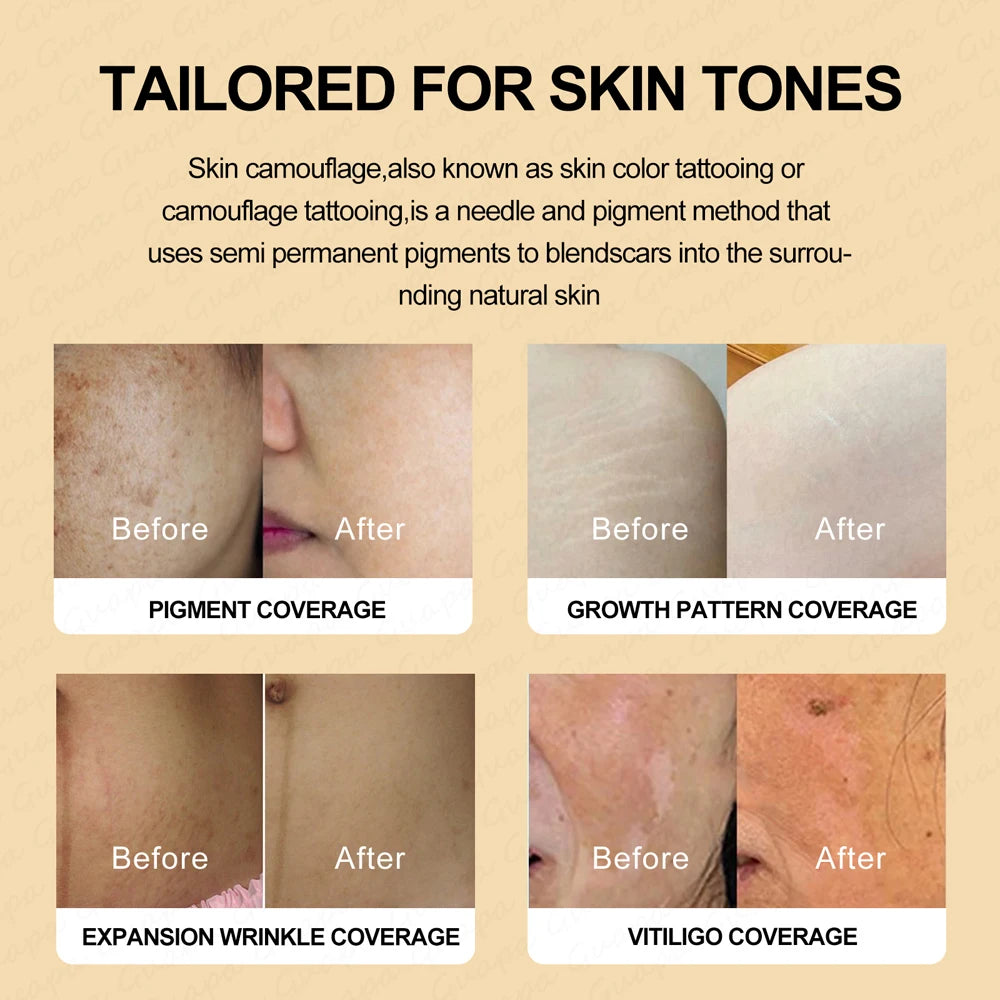 Guapa 10ml Permanent Makeup Ink Stretch Mark Camouflage Pigments Skin Tone Scar Camouflage Tattoo Ink for Restore Skin Tone