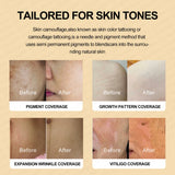 Guapa 10ml Permanent Makeup Ink Stretch Mark Camouflage Pigments Skin Tone Scar Camouflage Tattoo Ink for Restore Skin Tone