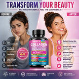 High Strength Collagen Complex, with Biotin, Hyaluronic Acid, Antioxidant, for Firm Skin, Strong Joints, Bone, Hair and Nails