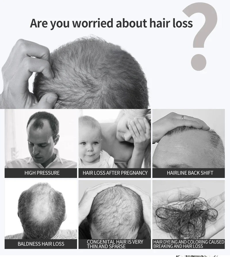 Hair Growth Serum 7 Days Fast Regrowth Essential Capsule Anti Hair Loss Baldness Repair Damaged Scalp Treatment For Women Men