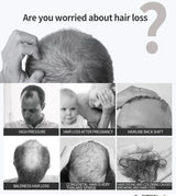 Hair Growth Serum 7 Days Fast Regrowth Essential Capsule Anti Hair Loss Baldness Repair Damaged Scalp Treatment For Women Men
