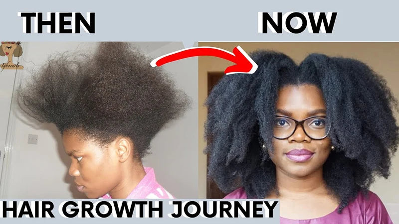 Fast Hair Growth Set Batana Oil Traction Alopecia Hair Mask Anti Break Loss Hair Growth Oil Baldness Treatment Hair Health Care