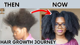 Fast Hair Growth Set Batana Oil Traction Alopecia Hair Mask Anti Break Loss Hair Growth Oil Baldness Treatment Hair Health Care