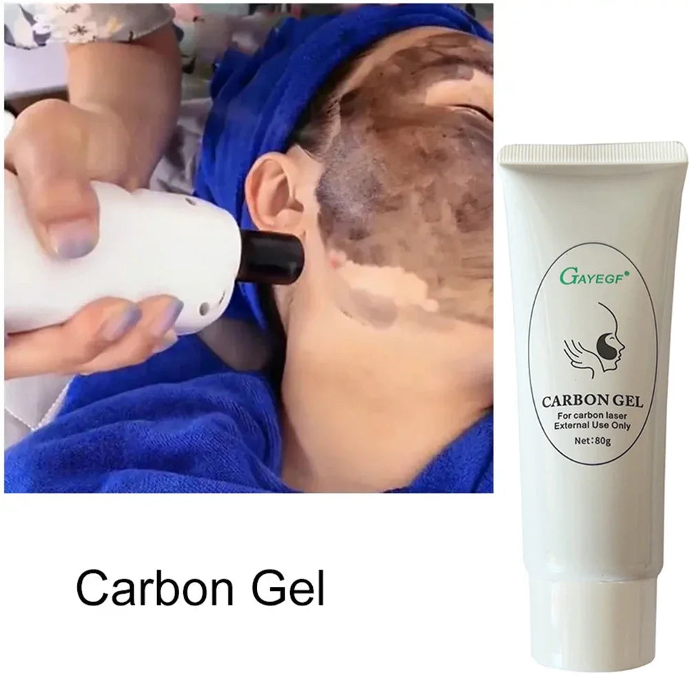 NEW Date Black Gel Mask For ND YAG Laser Skin Peeling Carbon Cream Whitening Peel Deep Cleaning Facial Rejuvenation Moisturizing