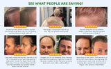 Fast Hair Growth Set Batana Oil Traction Alopecia Hair Mask Anti Break Loss Hair Growth Oil Baldness Treatment Hair Health Care
