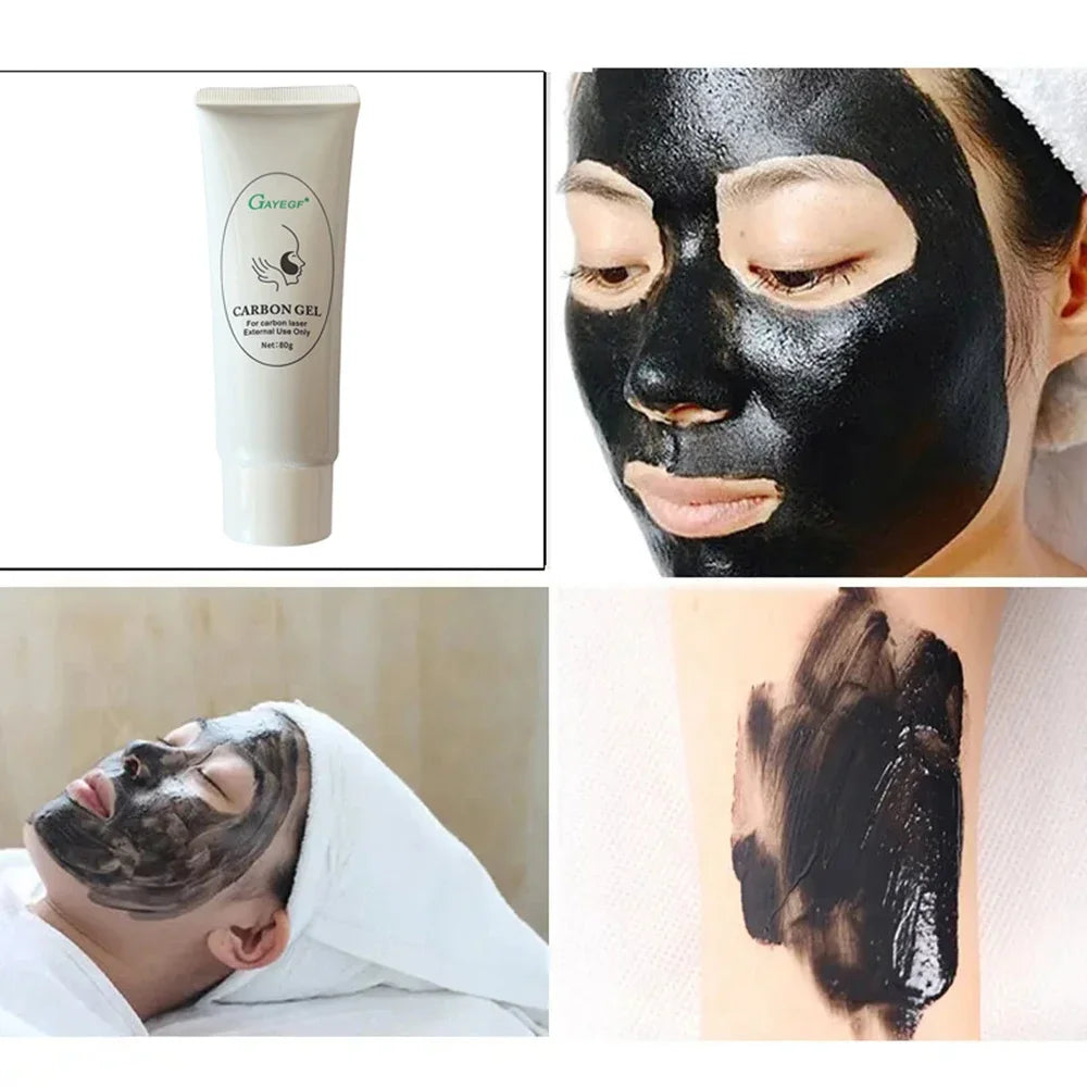 NEW Date Black Gel Mask For ND YAG Laser Skin Peeling Carbon Cream Whitening Peel Deep Cleaning Facial Rejuvenation Moisturizing