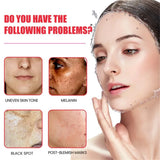 Powerful Dark Spots Remover Whitening Serum Face Freckle Melanin Correcting Anti Pigmentation Brighten Skin Beauty Care Essence