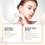 Salicylic Acid Serum for Acne Drying Lotion Acne Treatment Sensitive Skin Care Pimples Acne Remover Serum Cream Anti Acne Serum