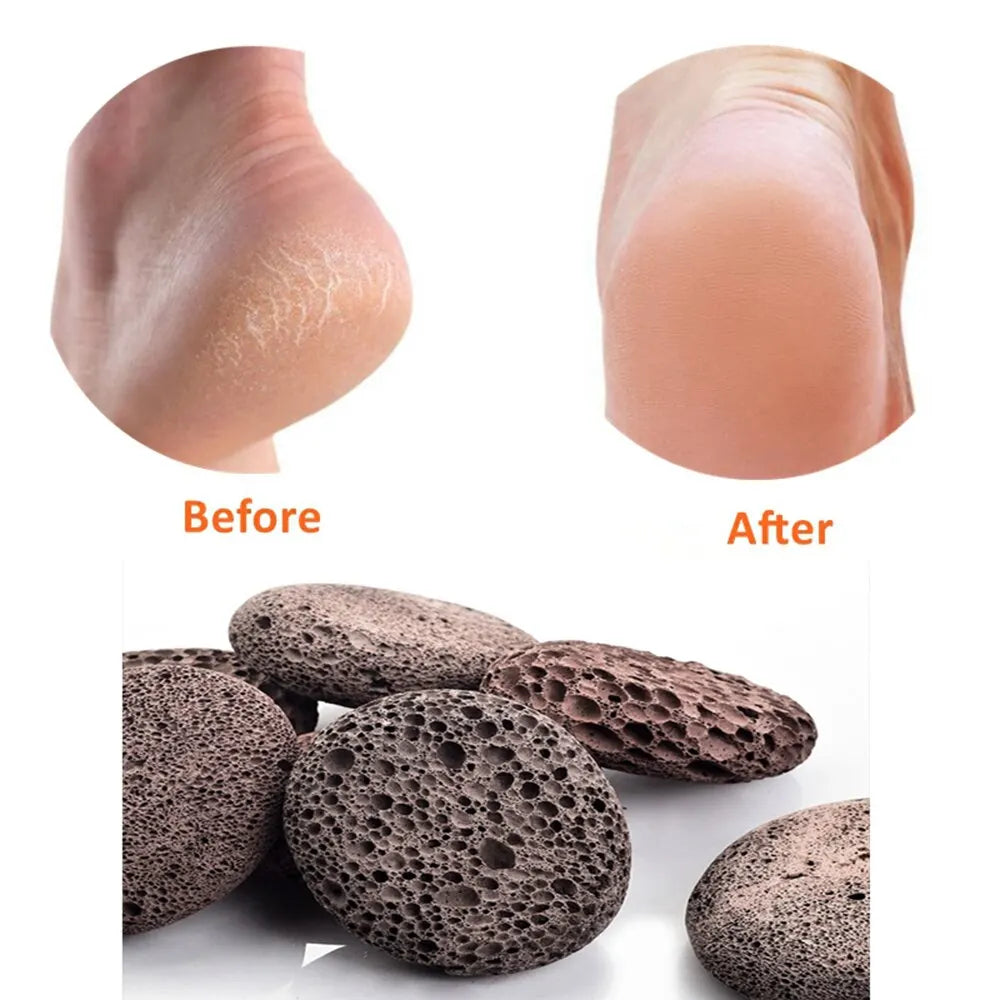 Pumice Stone , Scrubber Stone Pedicure Tools Natural Foot Scrubber for Exfoliation to Clear Callus on Hands Heels and Body