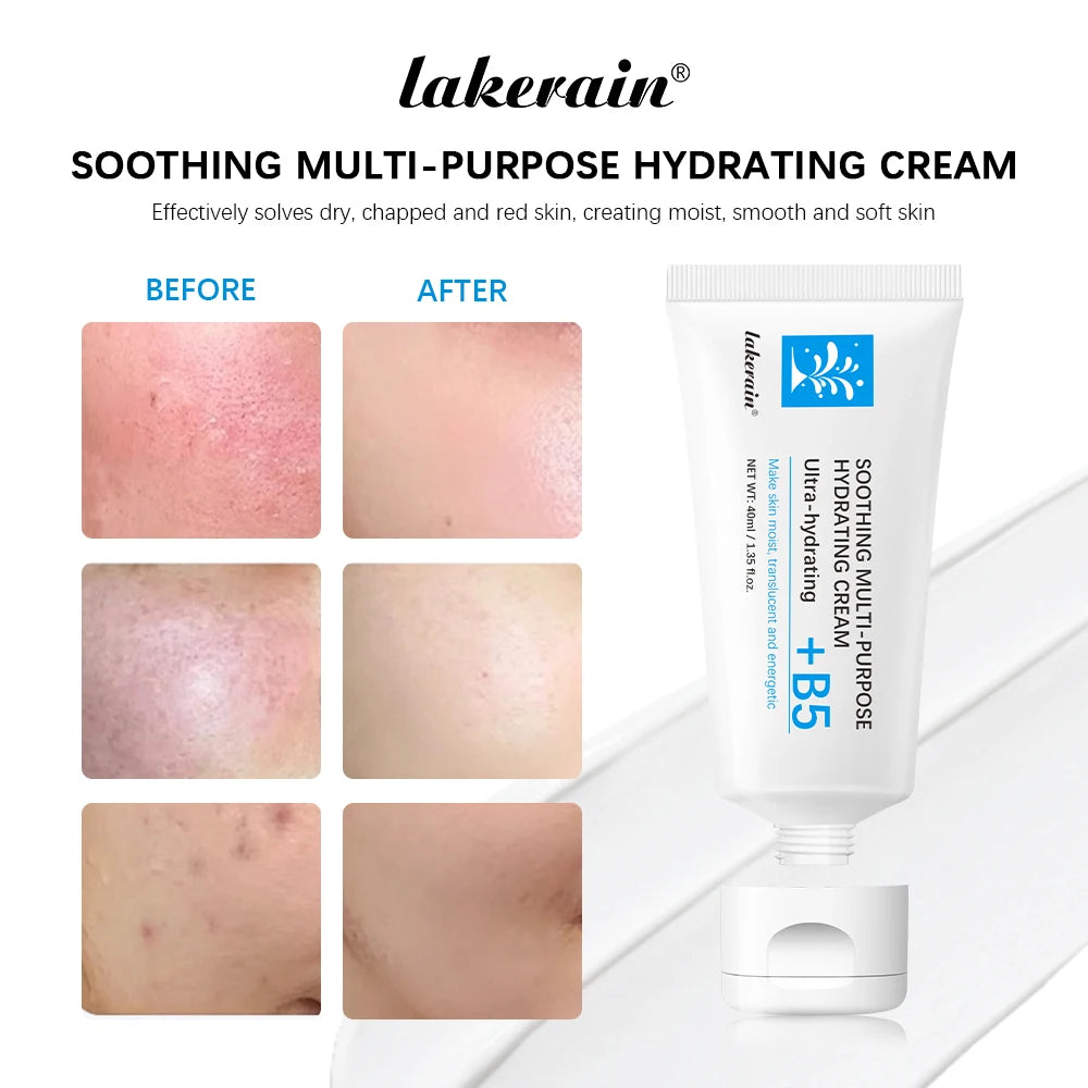 B5 Repair Cream Moisturizing Hydrating Effectively Solves Dry Chapped And Red Skin Nourishes Improve Repair Sunscreen Cream