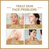 150ml Rice Toner Moisturizing Skin Care Hydrating Soothing Gentle Nourishing Brightening For Young Glowy Korean Skin Care