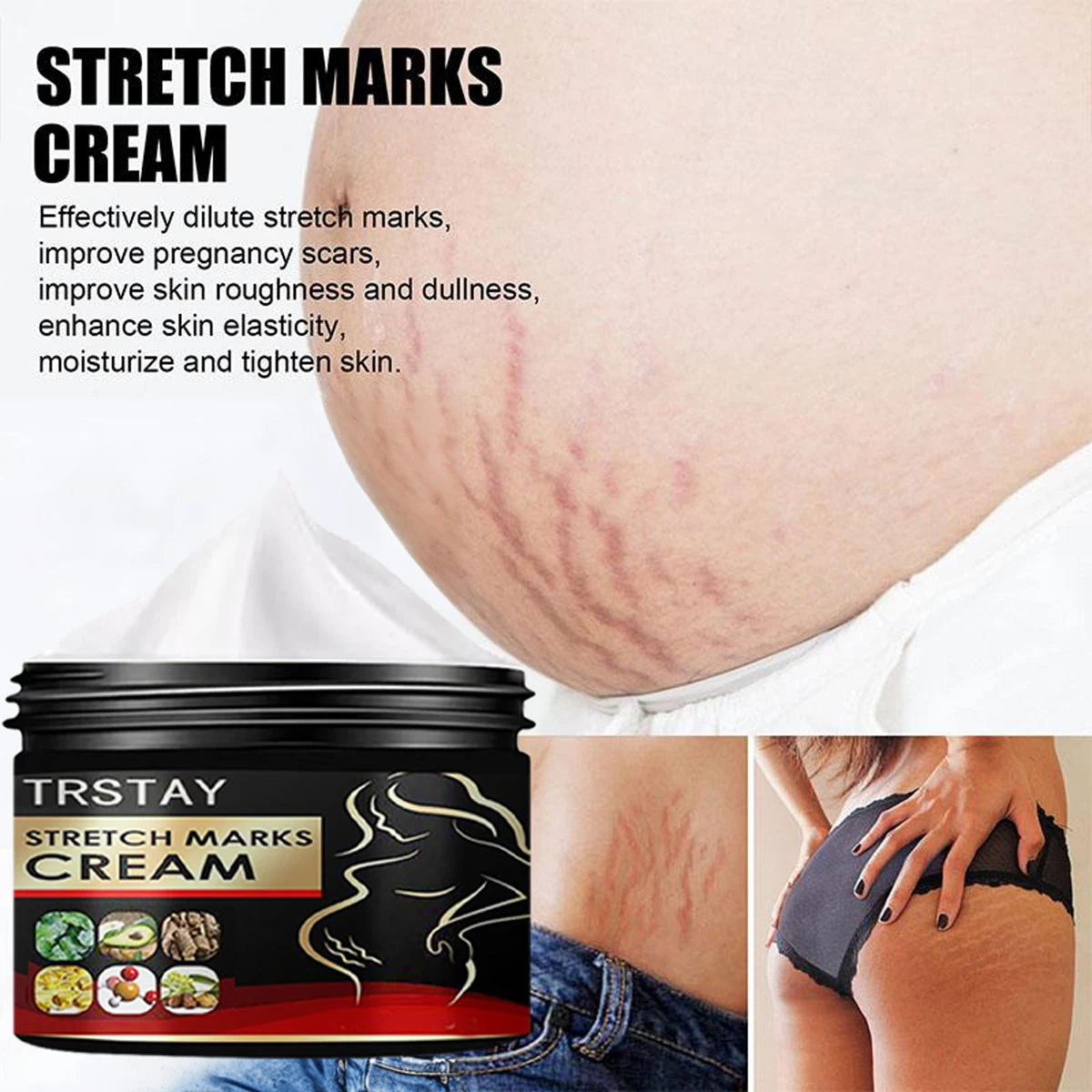 TRSTAY Stretch Mark Cream for Pregnancy Skin Replenish And Repair Cell Growth Promotion Maternity Striae Gravidarum Care