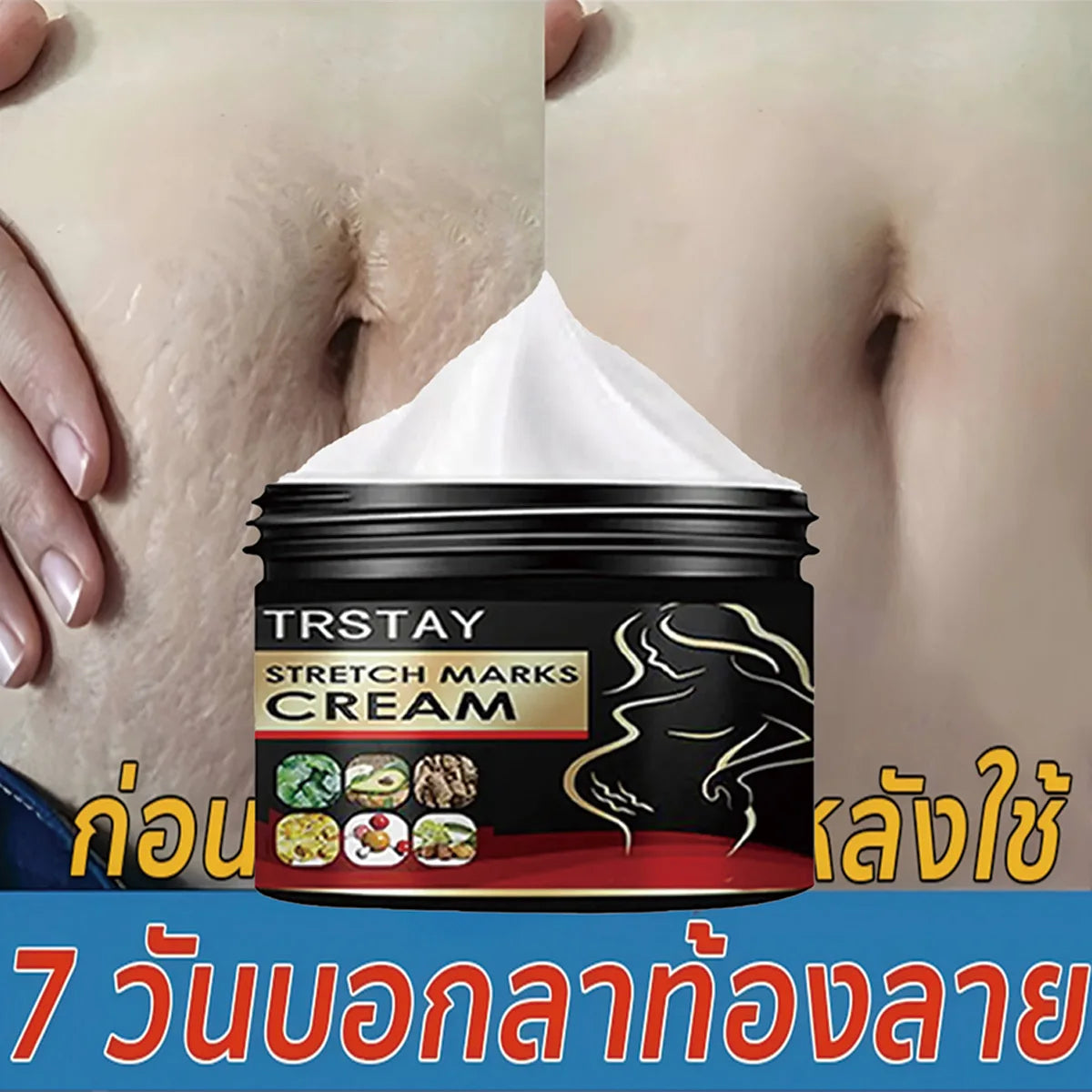 TRSTAY Stretch Mark Cream for Pregnancy Skin Replenish And Repair Cell Growth Promotion Maternity Striae Gravidarum Care