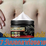 TRSTAY Stretch Mark Cream for Pregnancy Skin Replenish And Repair Cell Growth Promotion Maternity Striae Gravidarum Care