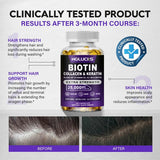 Biotin+Collagen+Keratin Capsules, Hydration, Promotes Hair Growth, Strengthens Weak Nails, Joints & Bones, Anti-Aging, Whitening