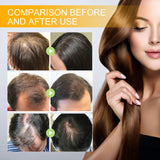 Biotin Hair Care Spray Nourish Scalp Hair Follicle Reduce Hair Loss Stabiliz Hair Root Refresh Oil Control Natural Plant Essence
