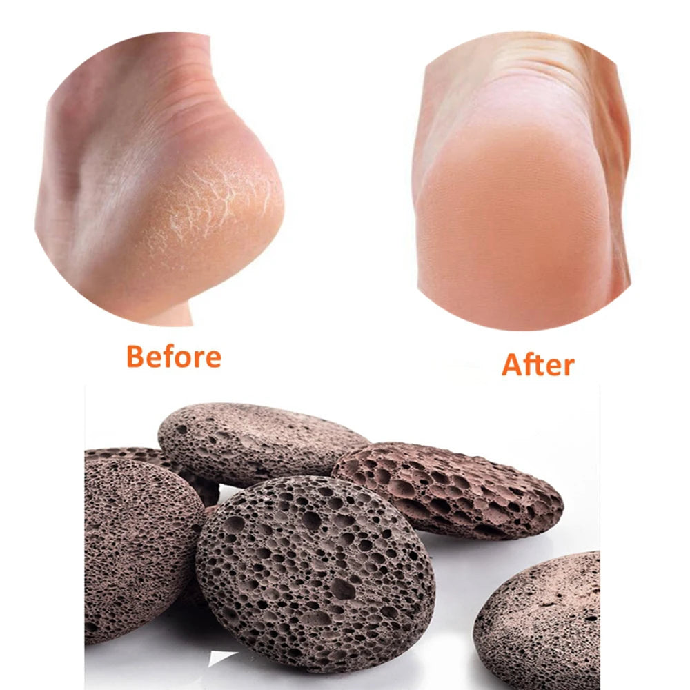 Pumice Stone , Scrubber Stone Pedicure Tools Natural Foot Scrubber for Exfoliation to Clear Callus on Hands Heels and Body