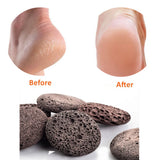 Pumice Stone , Scrubber Stone Pedicure Tools Natural Foot Scrubber for Exfoliation to Clear Callus on Hands Heels and Body