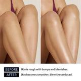 Lakerain Exfoliating Body Stick Multiple Glycolic Acid Cleaning Long-lasting Moisturizing Nourishing Smoothing Skin Care