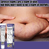 Stretch Mark Removal Cream Permanently Removes Stretch Marks Rejuvenates Skin Stretch Mark Removal Cream