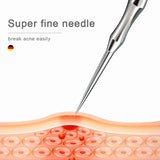 New Acne Needle Kit, Remove Blackheads, Pimples & Closed Comedones