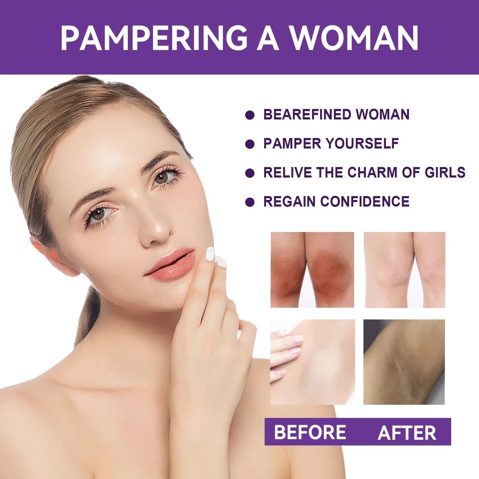 Whitening Body Lotion Cream Private Parts Underarm Lips Nipple Anal Bleaching Butt Knee Brighten Remove Melanin Skin Care 20g