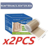 4cmx50cm Silicone Scar Sheet Painless Scar Repair Tape Removal Strip for C-Section Keloid Surgery Burn Acne Roll Effective Scar