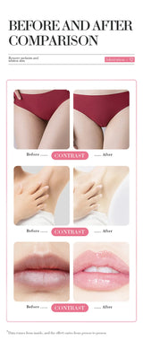 2pcs  Body Cream Lighten Melanin Pink Underarm Knees Inner Thighs Bleaching Cream Moisturizing Brightening Skin Care